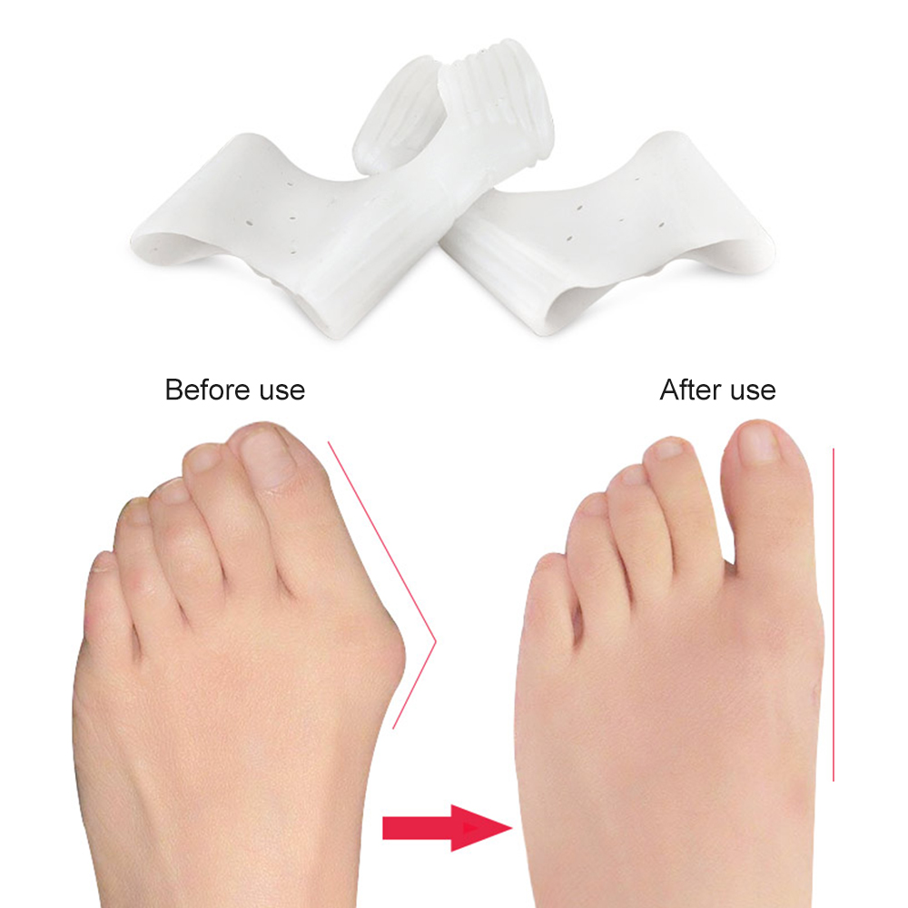 1Pair Silicone Bunion Correcto - Toe Separator Silicon recension och pris