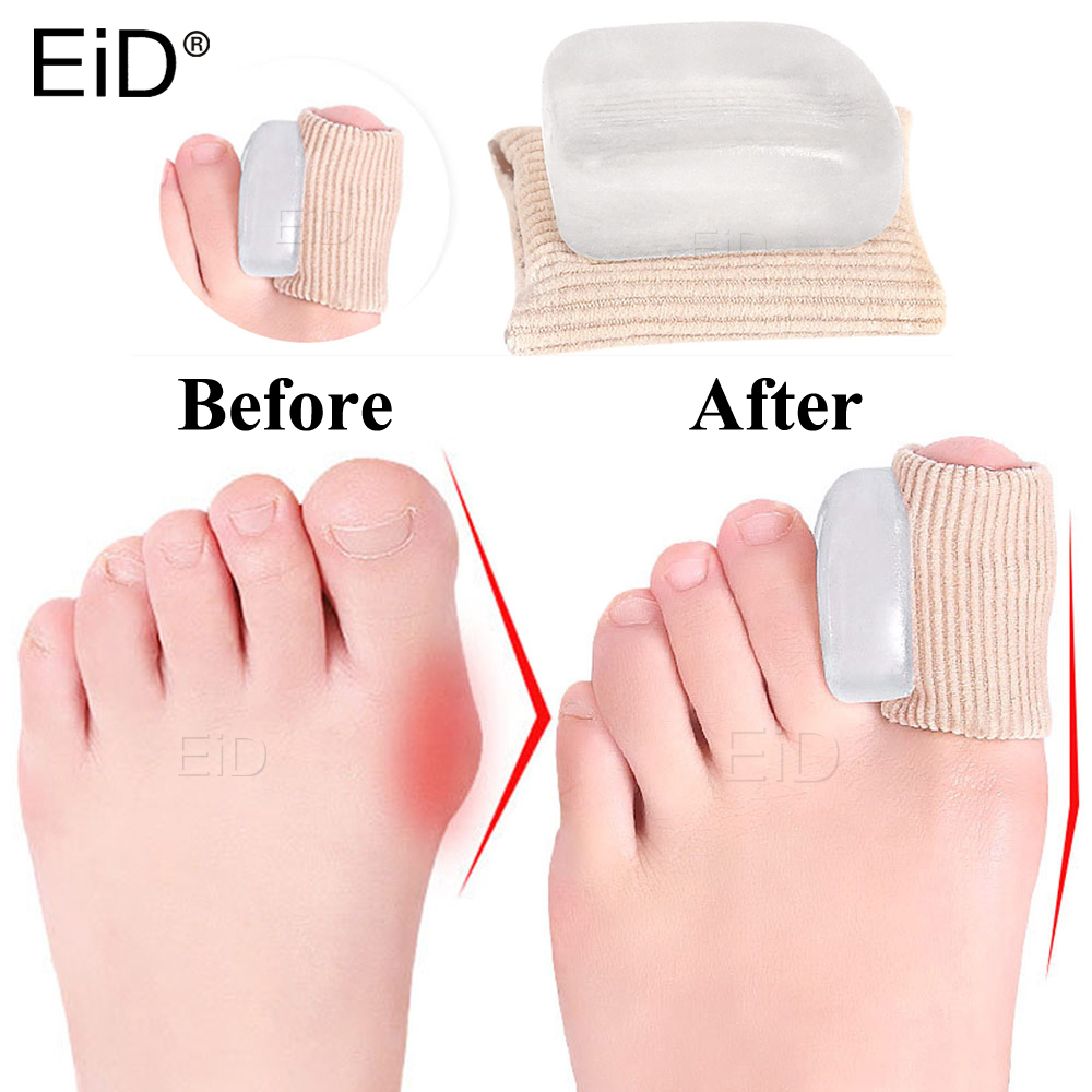 2 PCS Silicone Gel Thumb Corre - Toe Separator Silicon recension och pris