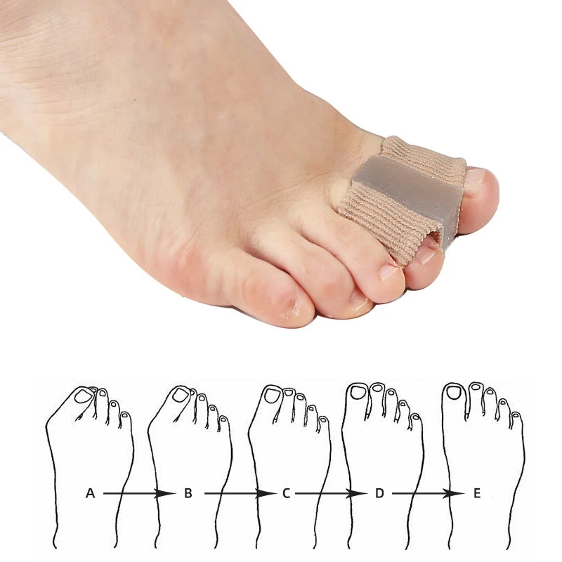 New Toe Separator Hallux Valgu - Toe Separator Silicon recension och pris